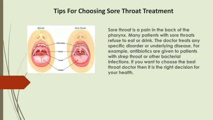 tips for c hoosing sore throat t reatment