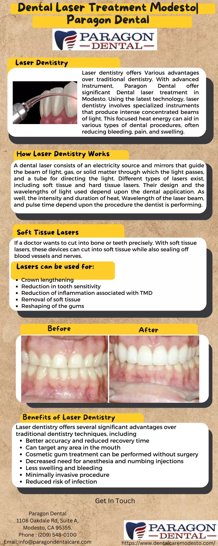 dental laser treatment modesto paragon dental