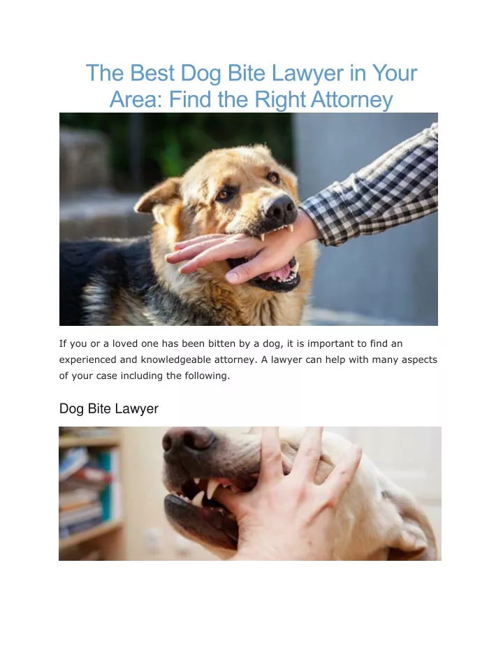 the best dog bite lawyer in your area find