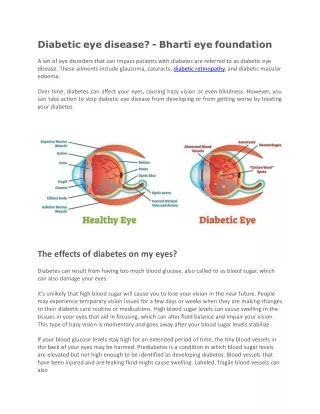 Diabetic eye disease ( for posting on websites ppt)