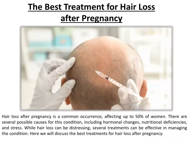 the best treatment for hair loss after pregnancy