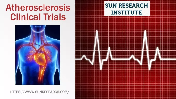 atherosclerosis clinical trials