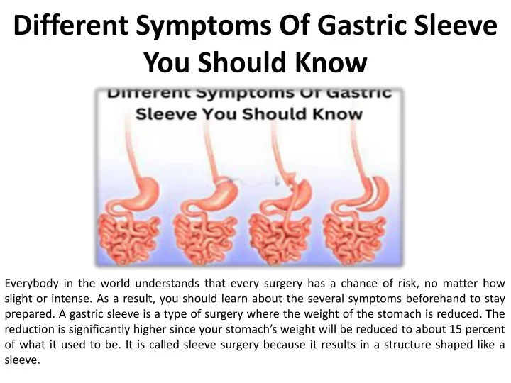 different symptoms of gastric sleeve you should