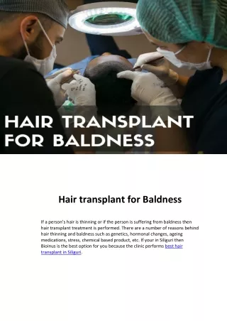 Hair transplant for Baldness