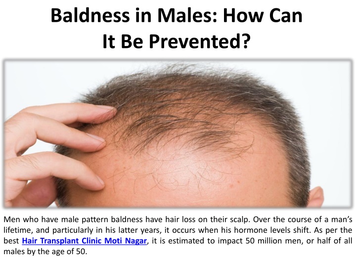 baldness in males how can it be prevented