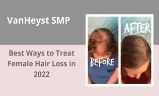Best Ways to Treat Female Hair Loss in 2022
