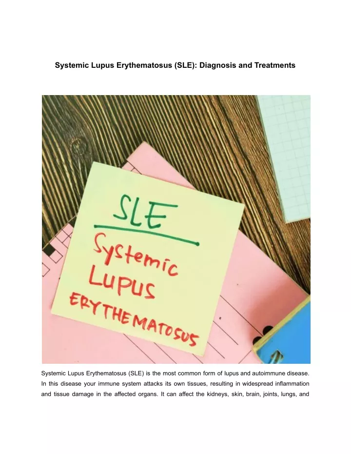 Ppt Systemic Lupus Erythematosus Sle Diagnosis And Treatments Powerpoint Presentation Id 7960