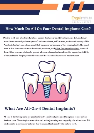 All On 4 Dental Implants Cost