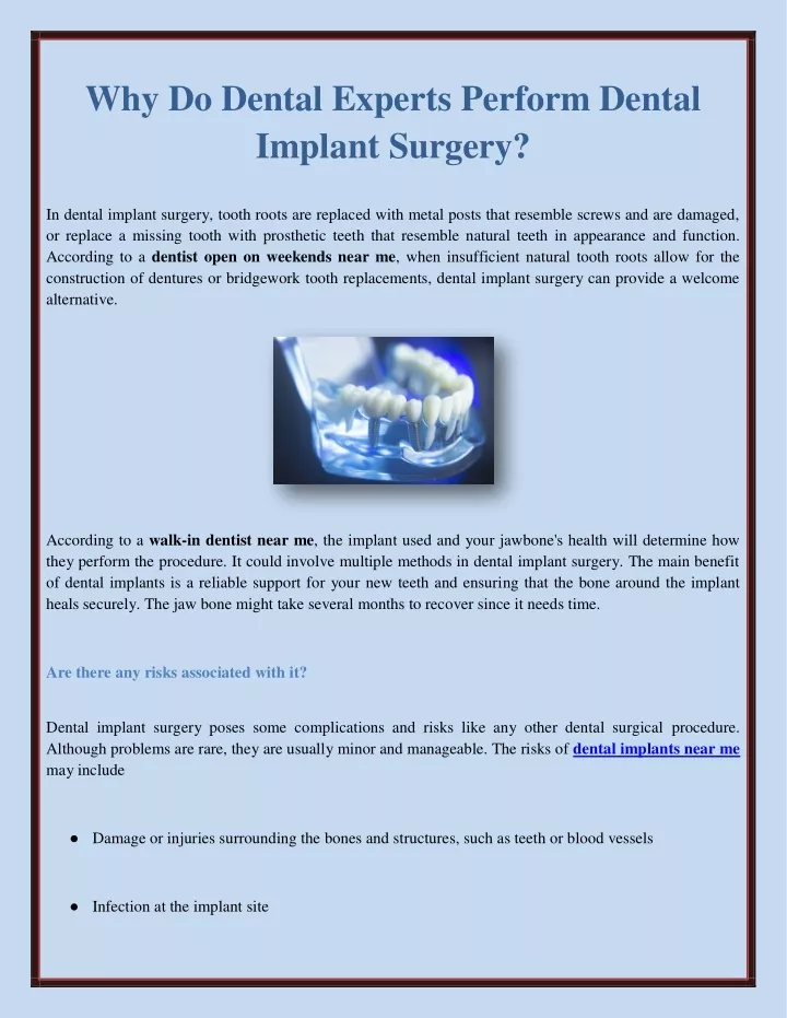 why do dental experts perform dental implant