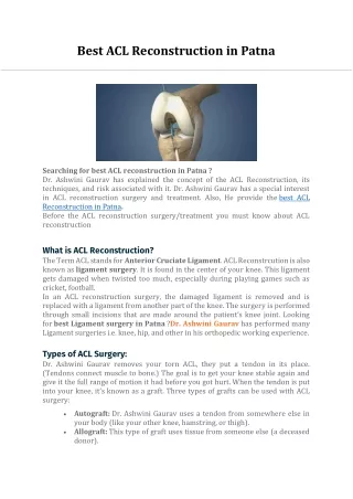 best acl reconstruction in patna