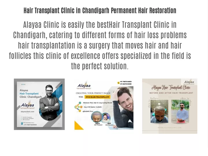 hair transplant clinic in chandigarh permanent