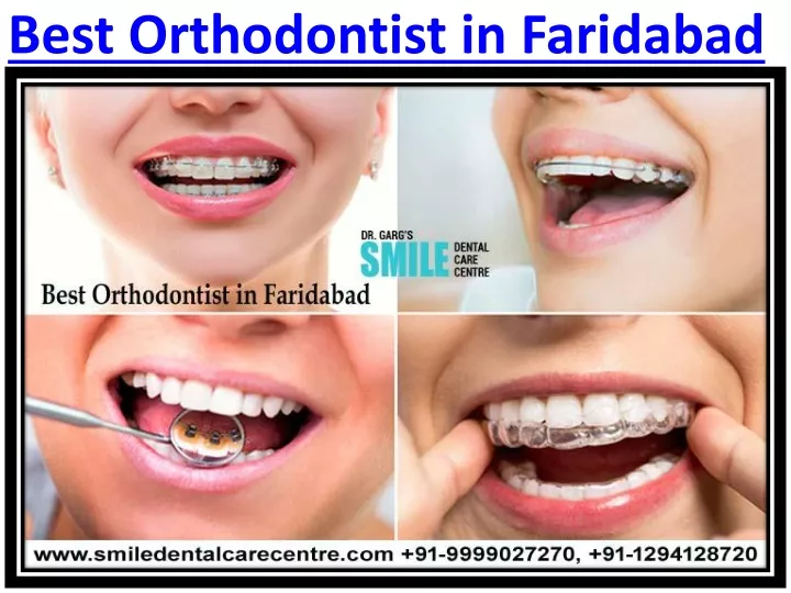 best orthodontist in faridabad