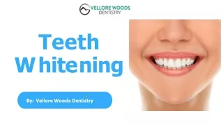 All You Need to Know About Teeth Whitening