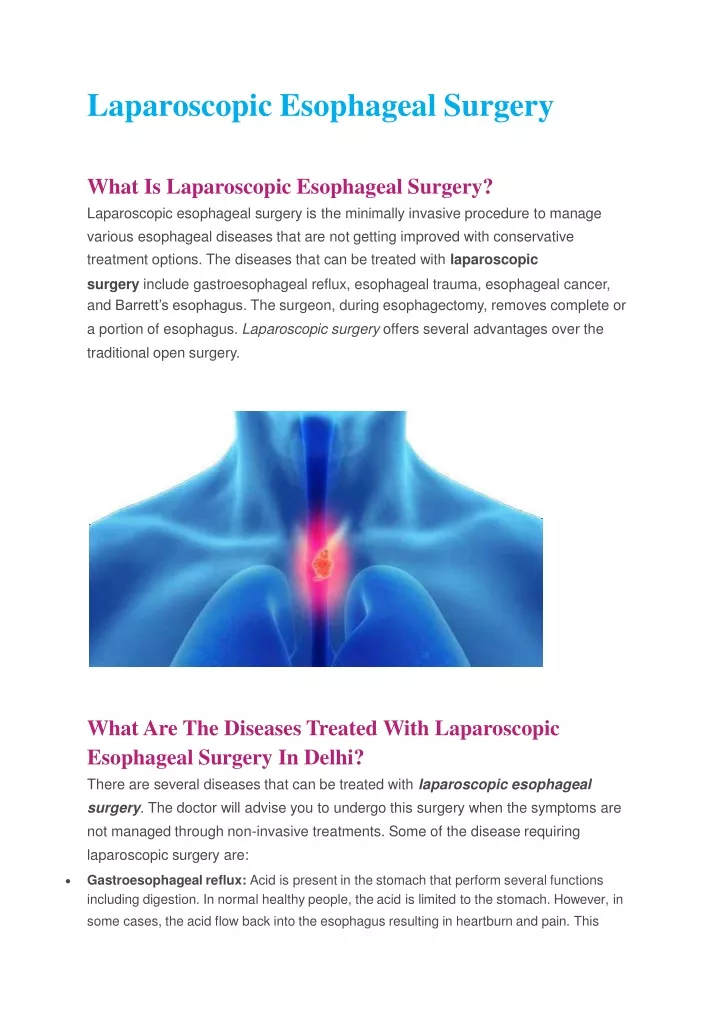 laparoscopic esophageal surgery