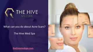 What can you do about Acne Scars - The Hive Med Spa