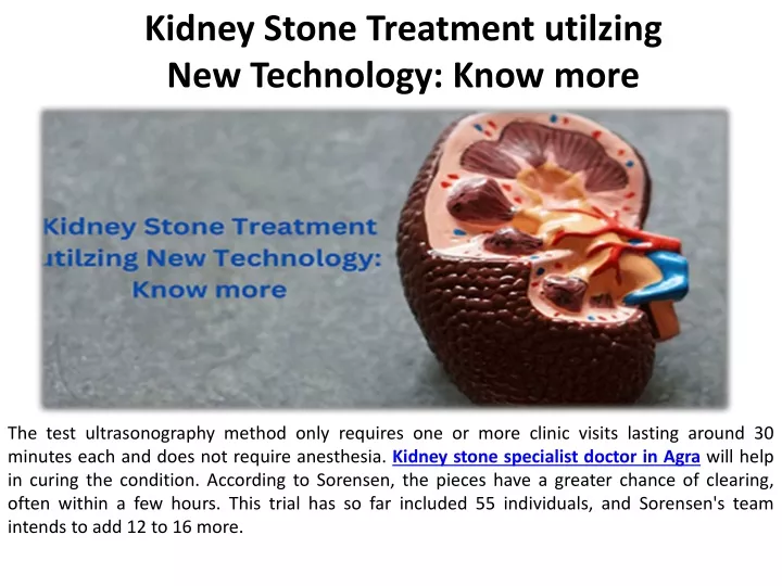 kidney stone treatment utilzing new technology