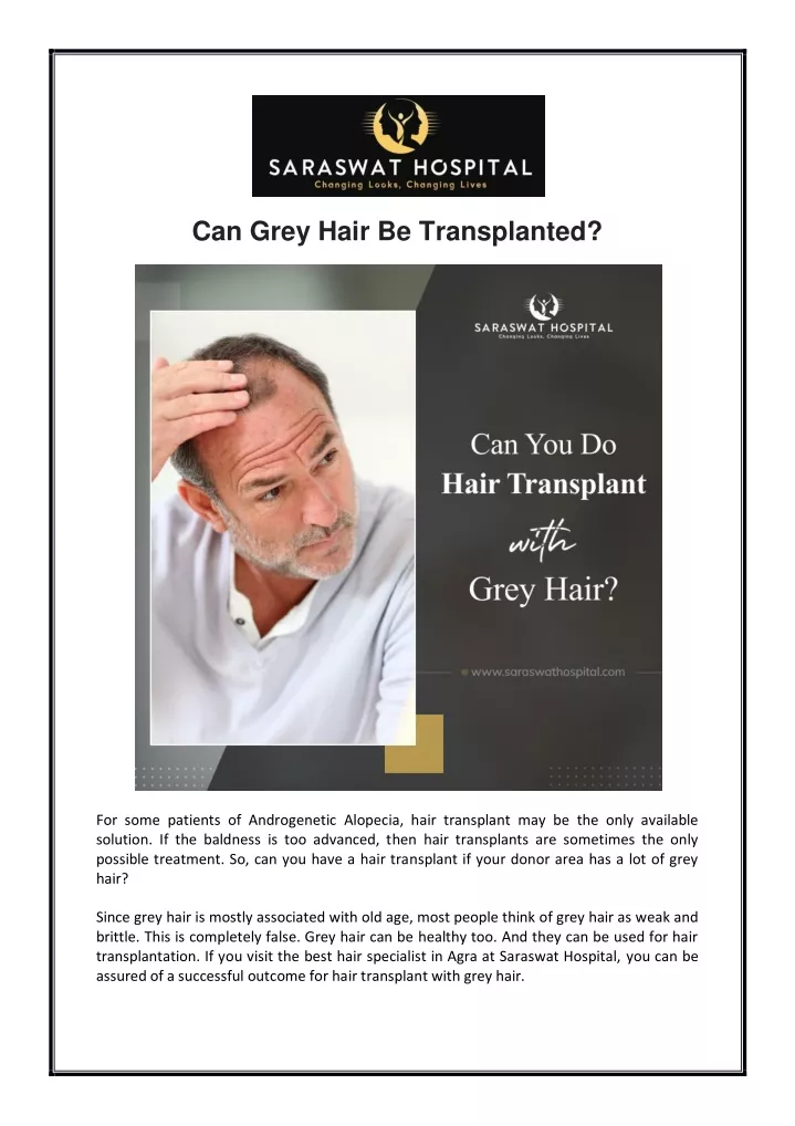 can grey hair be transplanted