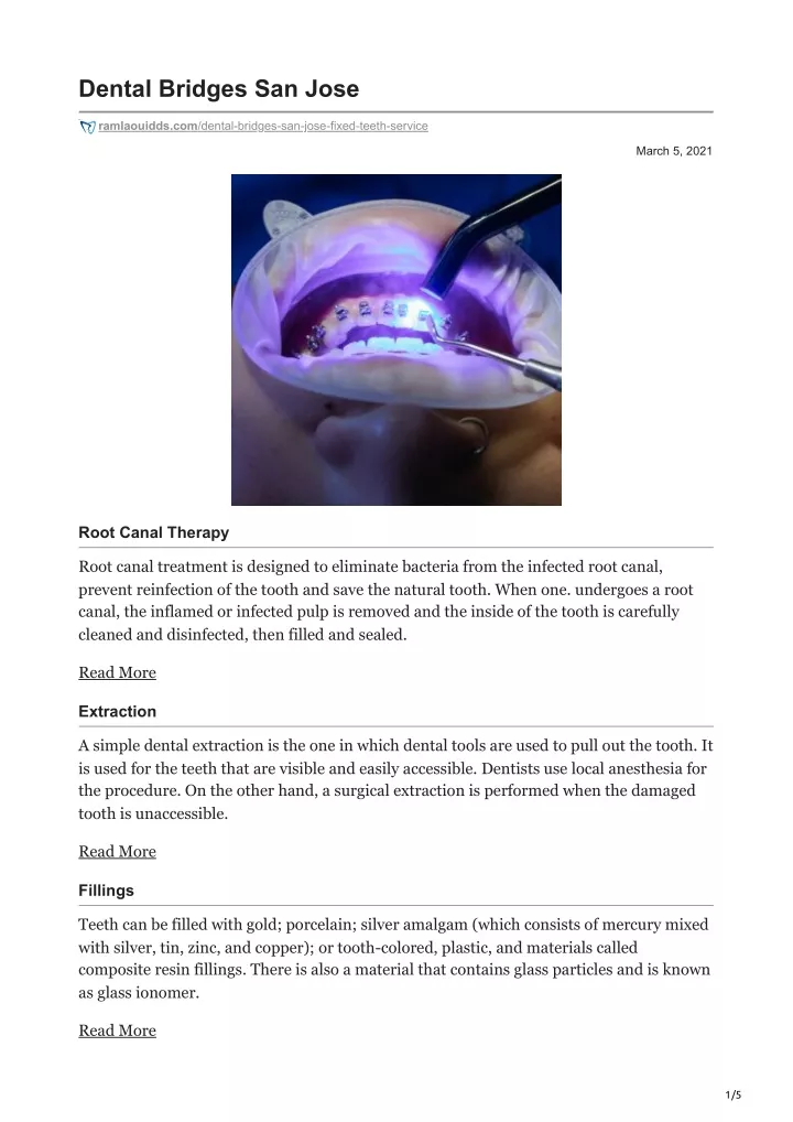 dental bridges san jose