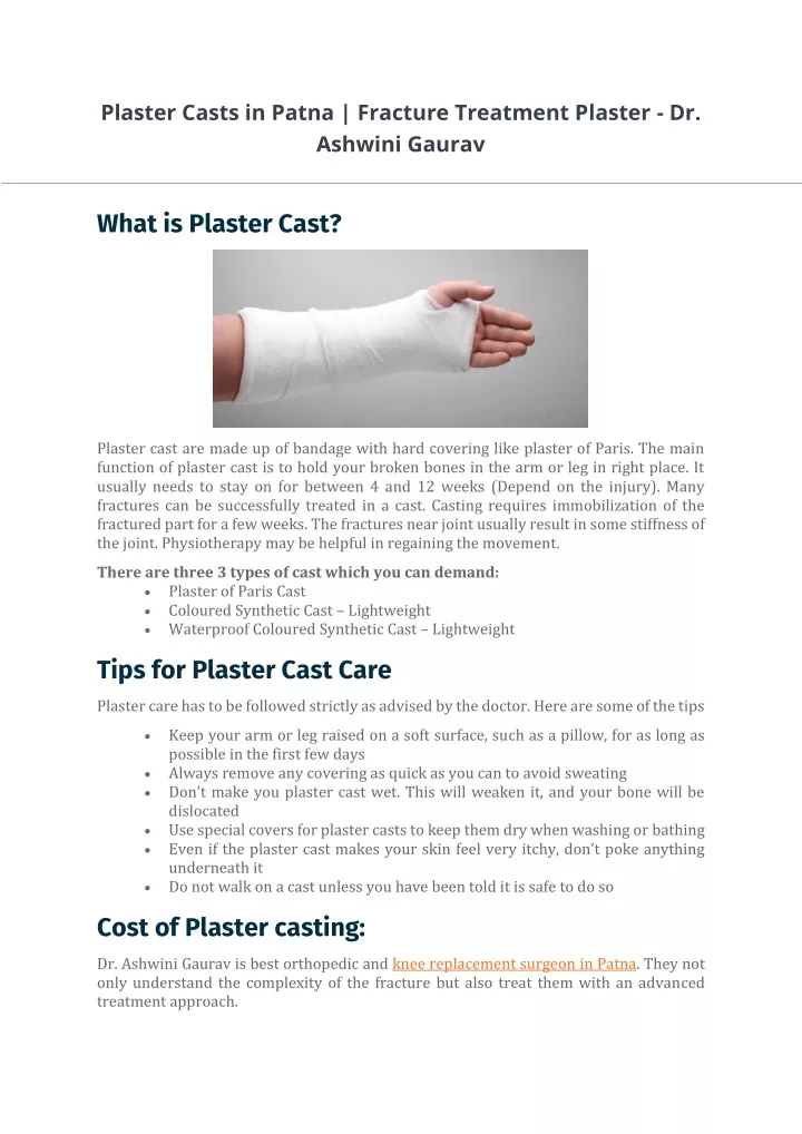 plaster casts in patna fracture treatment plaster