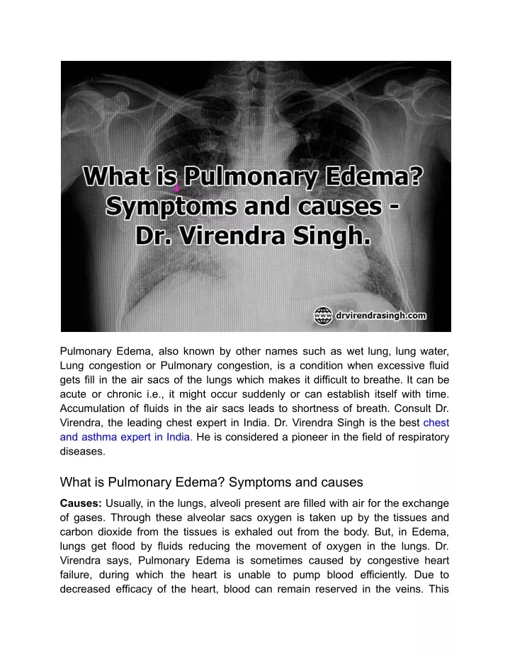 pulmonary edema also known by other names such