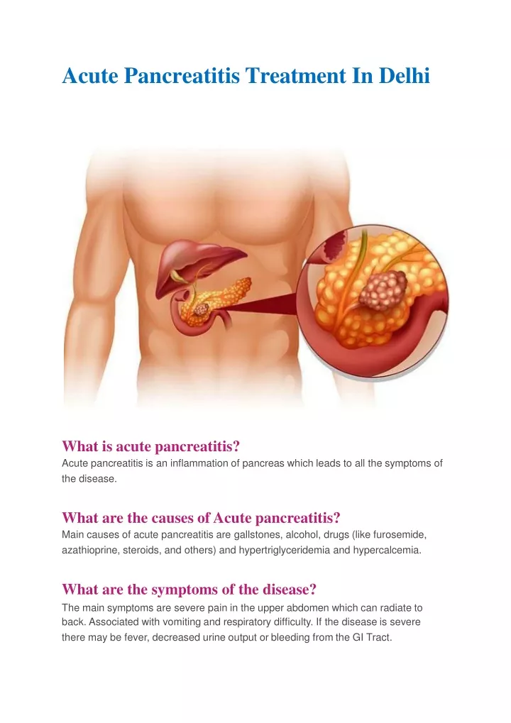 acute pancreatitis treatment in delhi