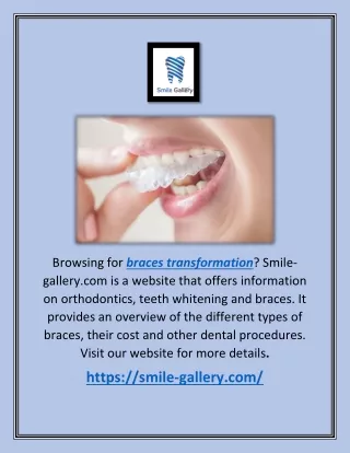 browsing for braces transformation smile gallery