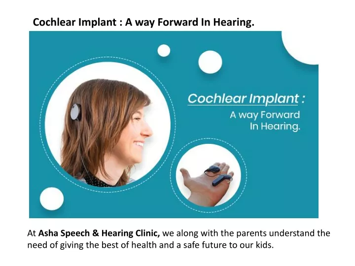 cochlear implant a way forward in hearing