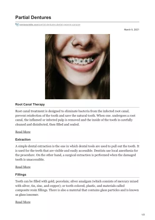 partial dentures