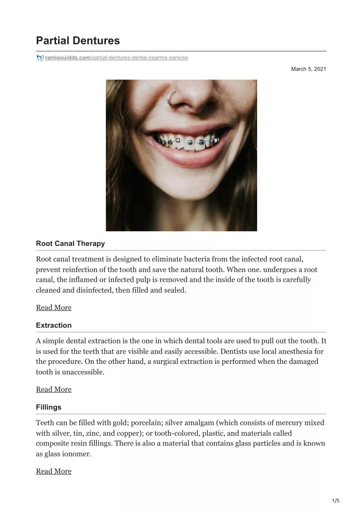 partial dentures