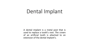 dental implant