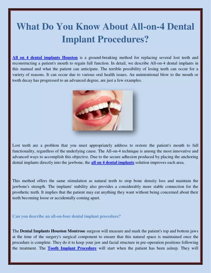 what do you know about all on 4 dental implant