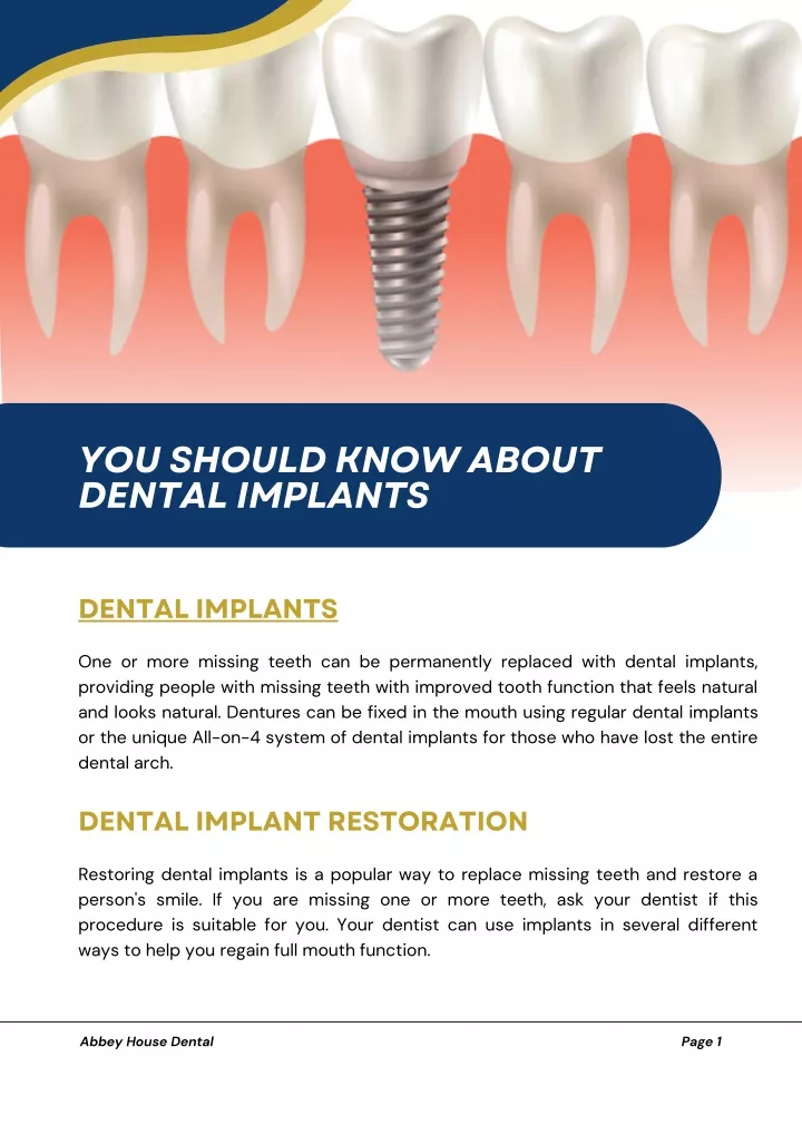 you should know about dental implants