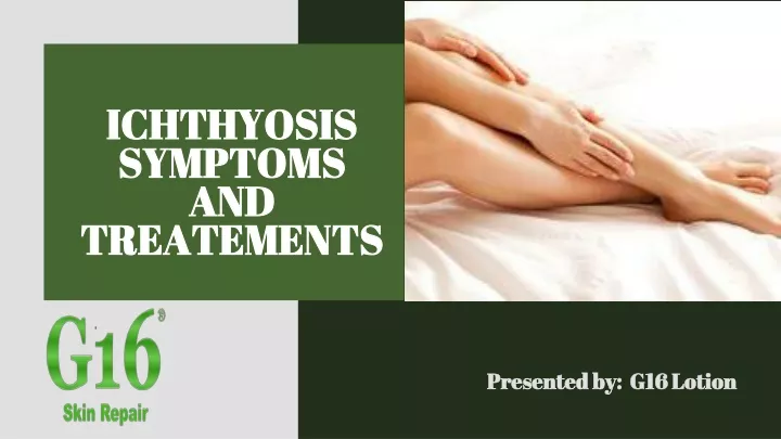 ichthyosis symptoms and treatements