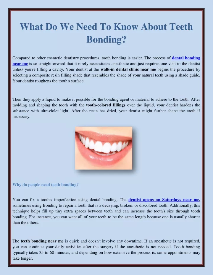 what do we need to know about teeth bonding