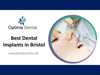 Best Dental Implants in Bristol - www.optimadentaloffice.com