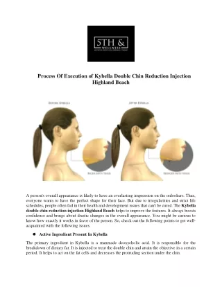 process of execution of kybella double chin