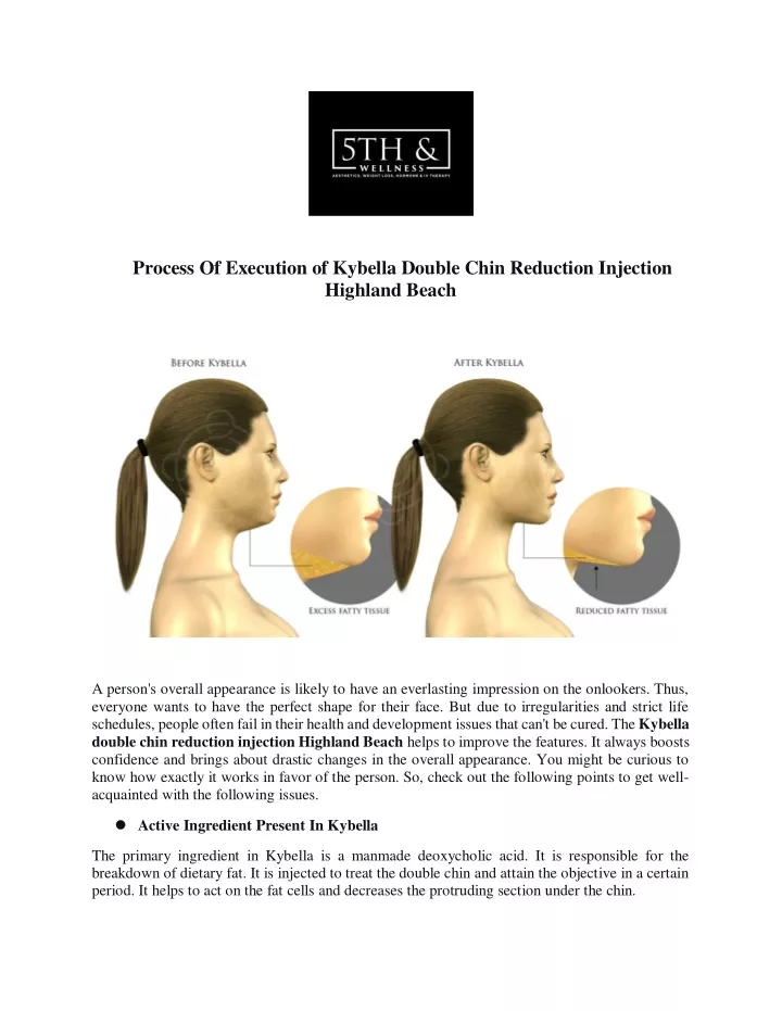 process of execution of kybella double chin