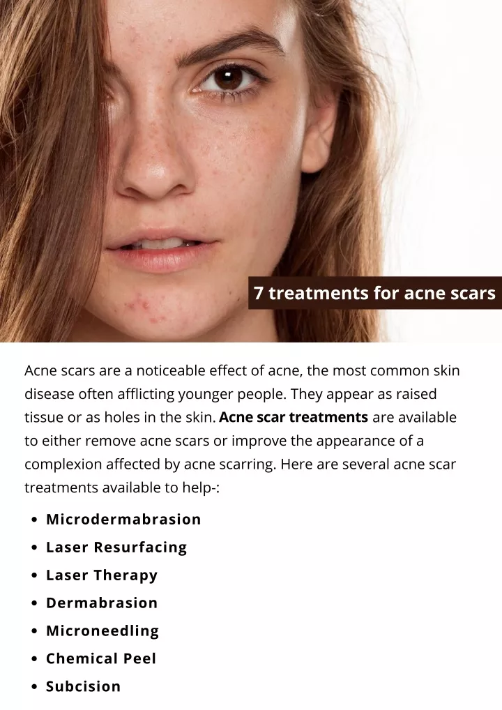 ppt-7-treatments-for-acne-scars-powerpoint-presentation-free