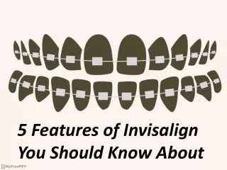 5 Features of Invisalign You Should Know About