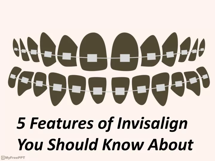 5 features of invisalign you should know about