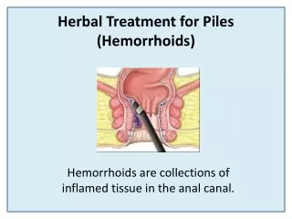 herbal treatment for piles hemorrhoids