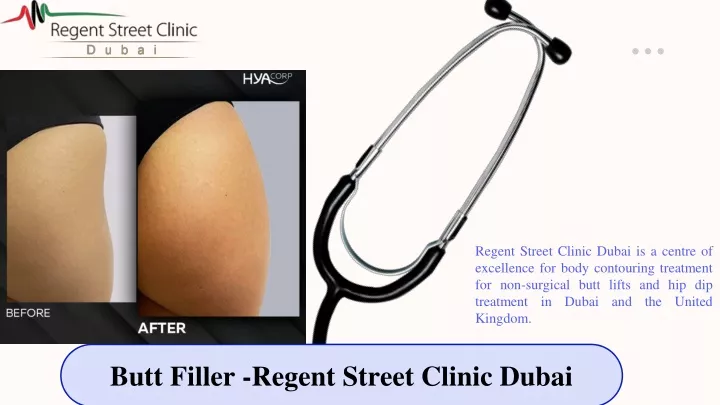 regent street clinic dubai is a centre