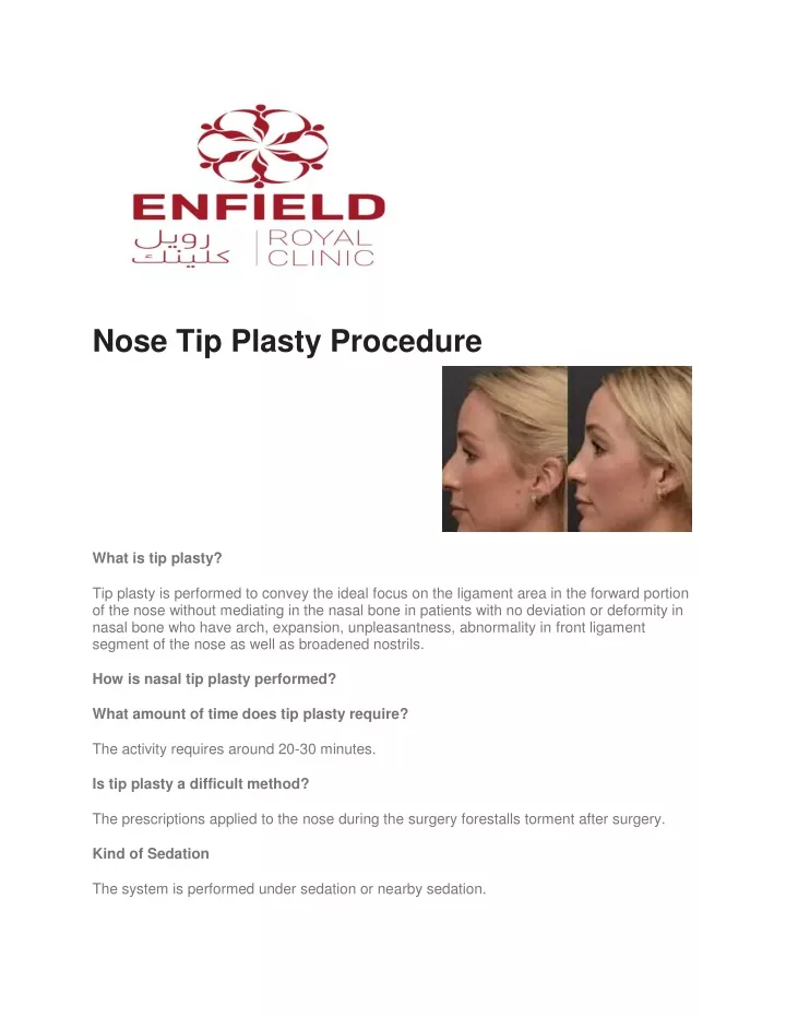 nose tip plasty procedure