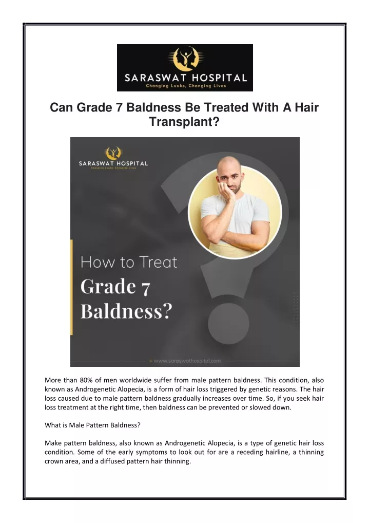 can grade 7 baldness be treated with a hair