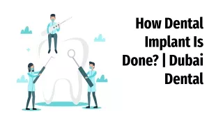 How Do Dental Implants Work? | Dental Clinic Dubai