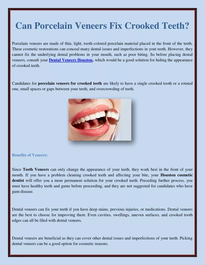 can porcelain veneers fix crooked teeth