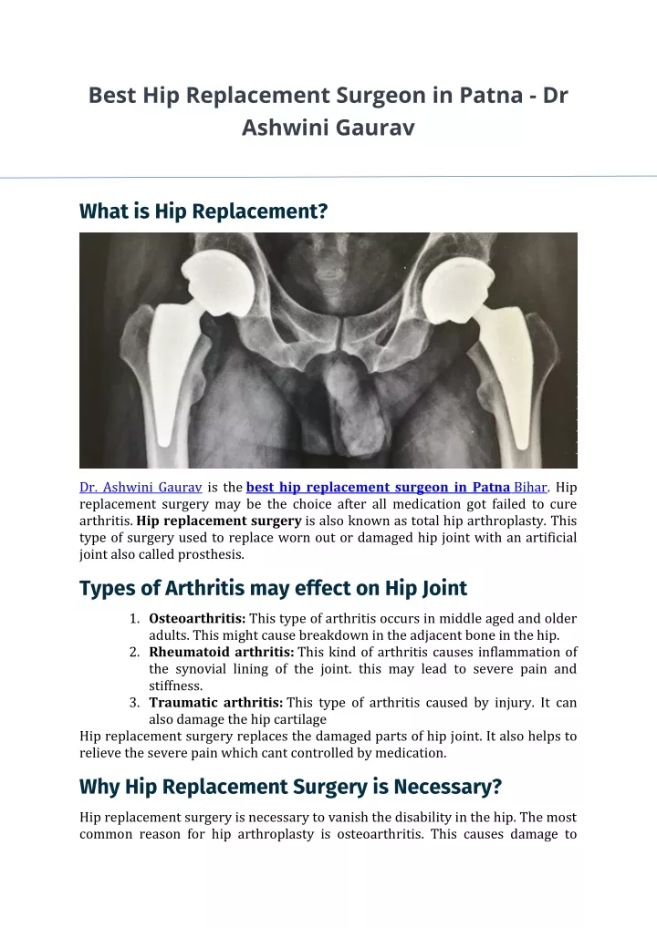 best hip replacement surgeon in patna dr ashwini