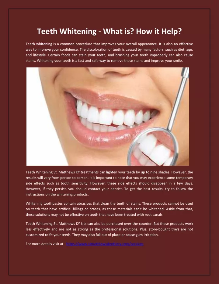 Ppt Teeth Whitening What Is How It Help Powerpoint Presentation