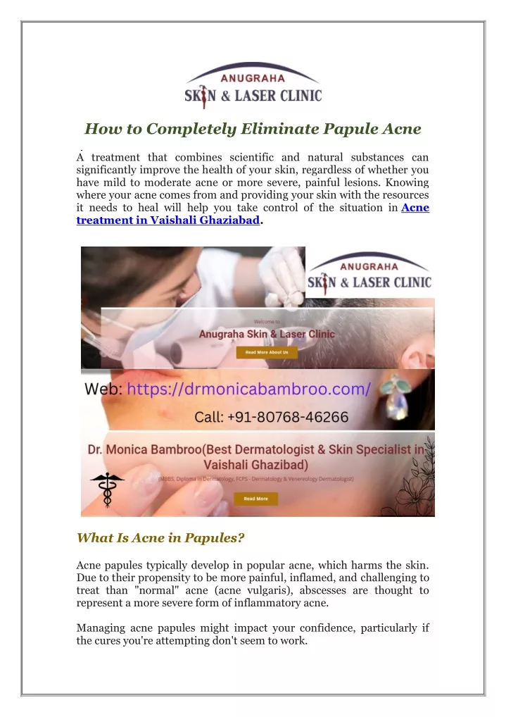 how to completely eliminate papule acne