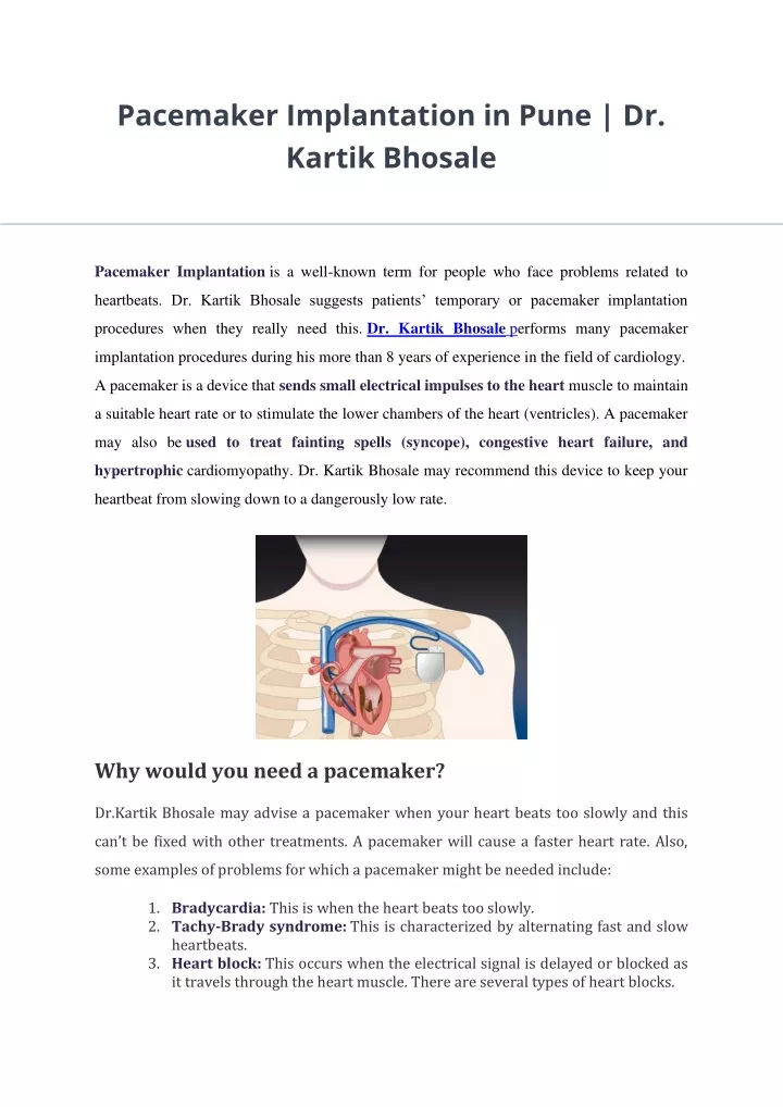 pacemaker implantation in pune dr kartik bhosale